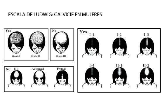 microinjerto-para-mujeres